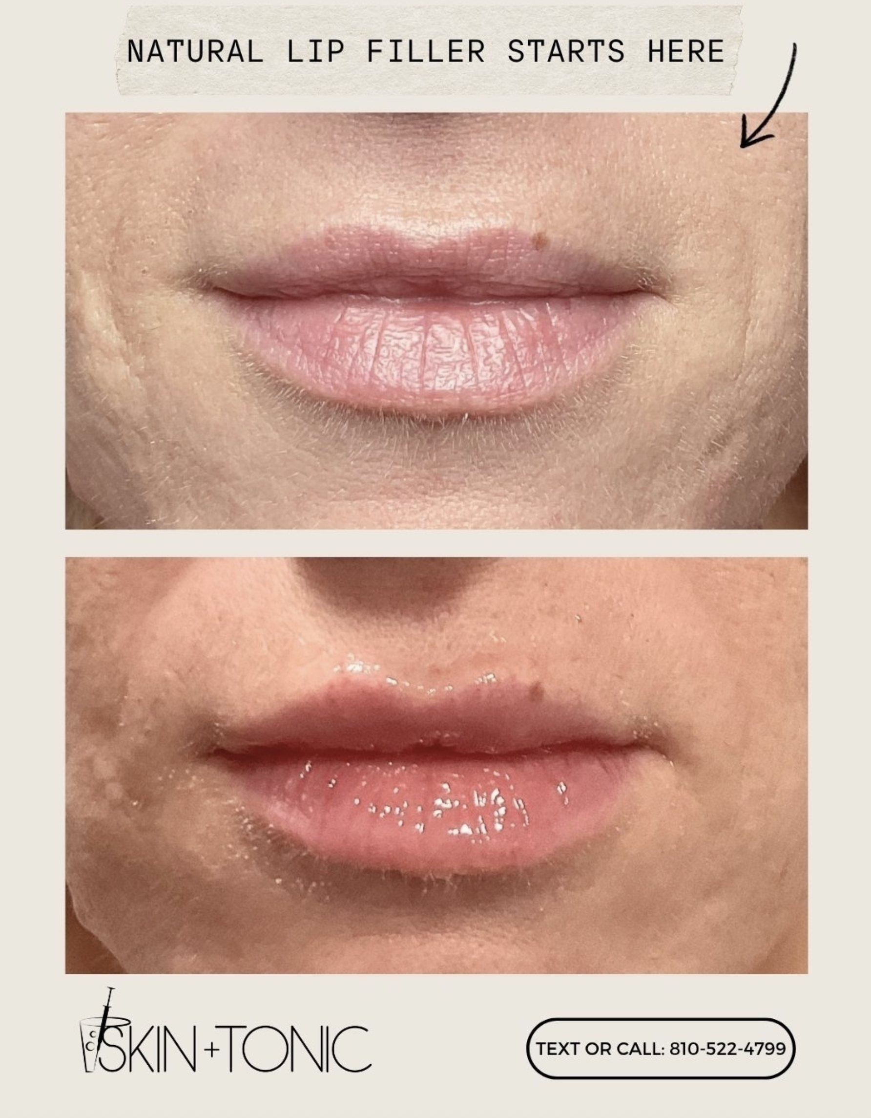 Skin & Tonic Brighton Instagram post