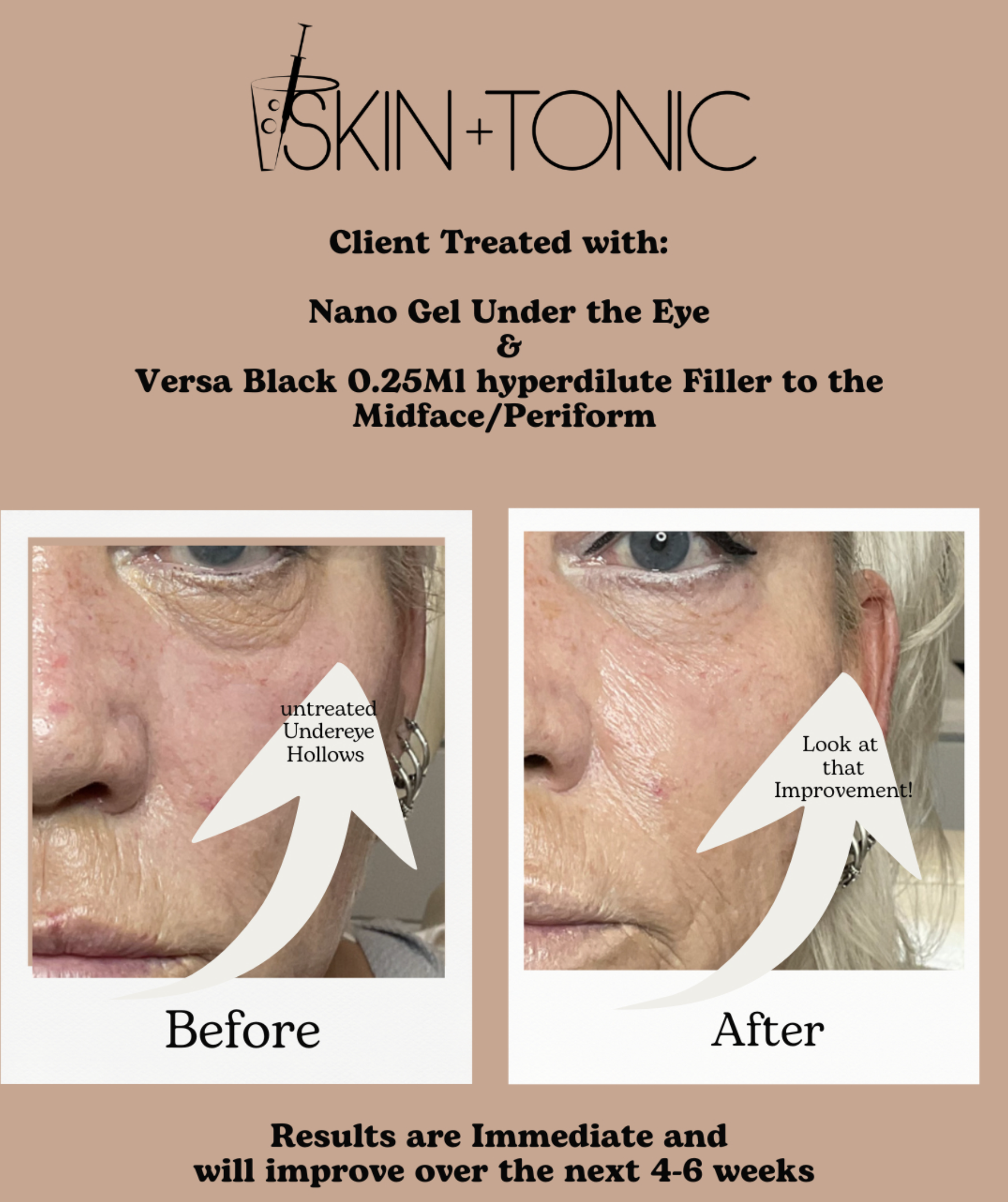 Skin & Tonic Brighton Instagram post