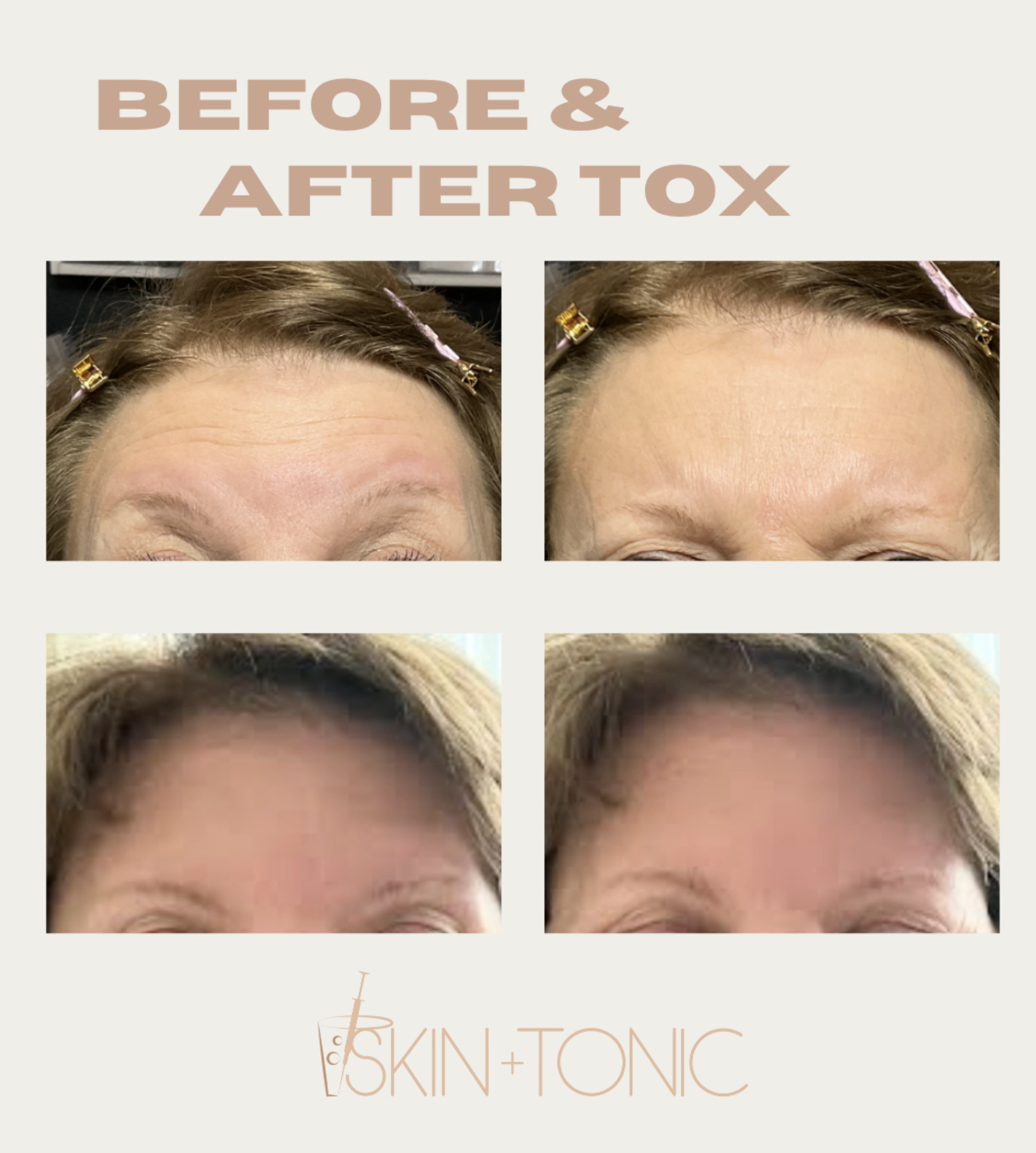 Skin & Tonic Brighton Instagram post