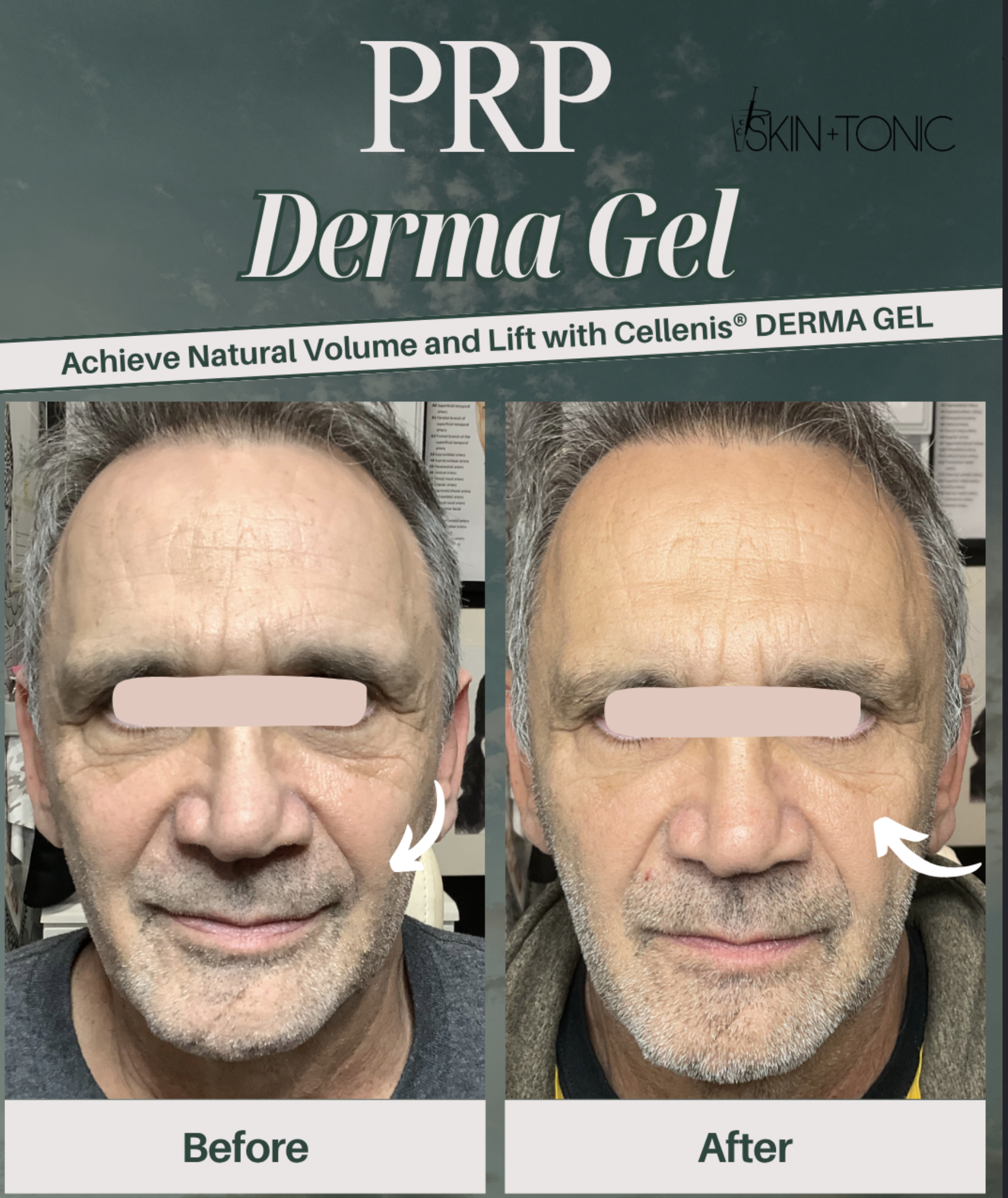 Skin & Tonic Brighton Instagram post