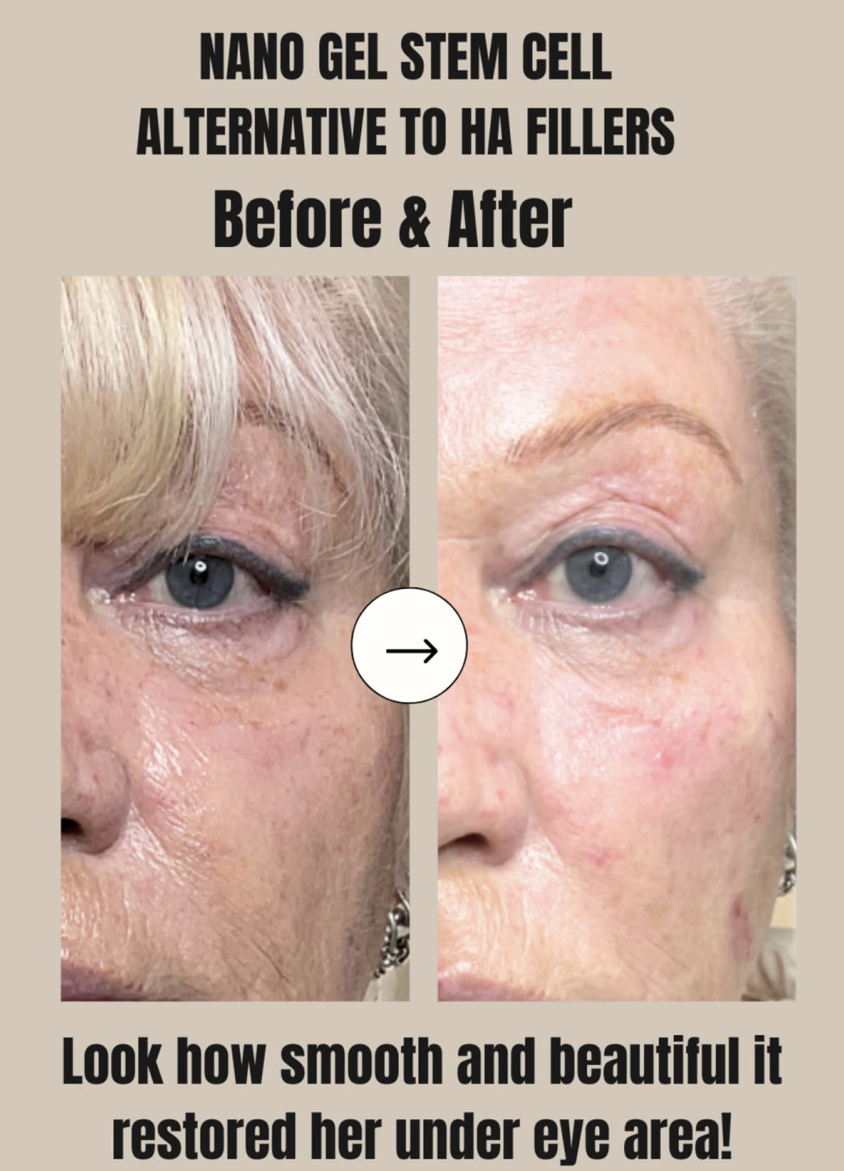 Skin & Tonic Brighton Instagram post