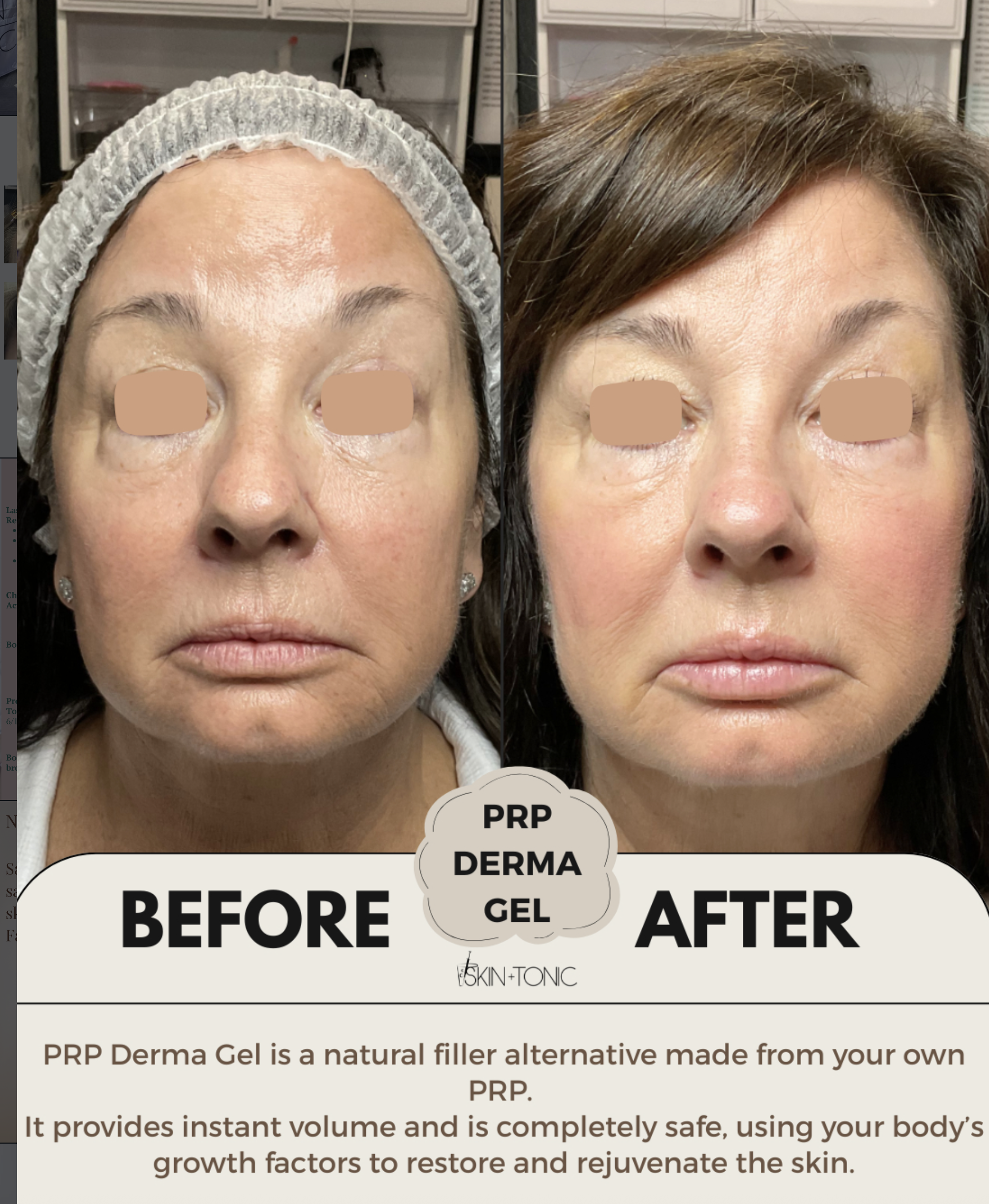 Skin & Tonic Brighton Instagram post