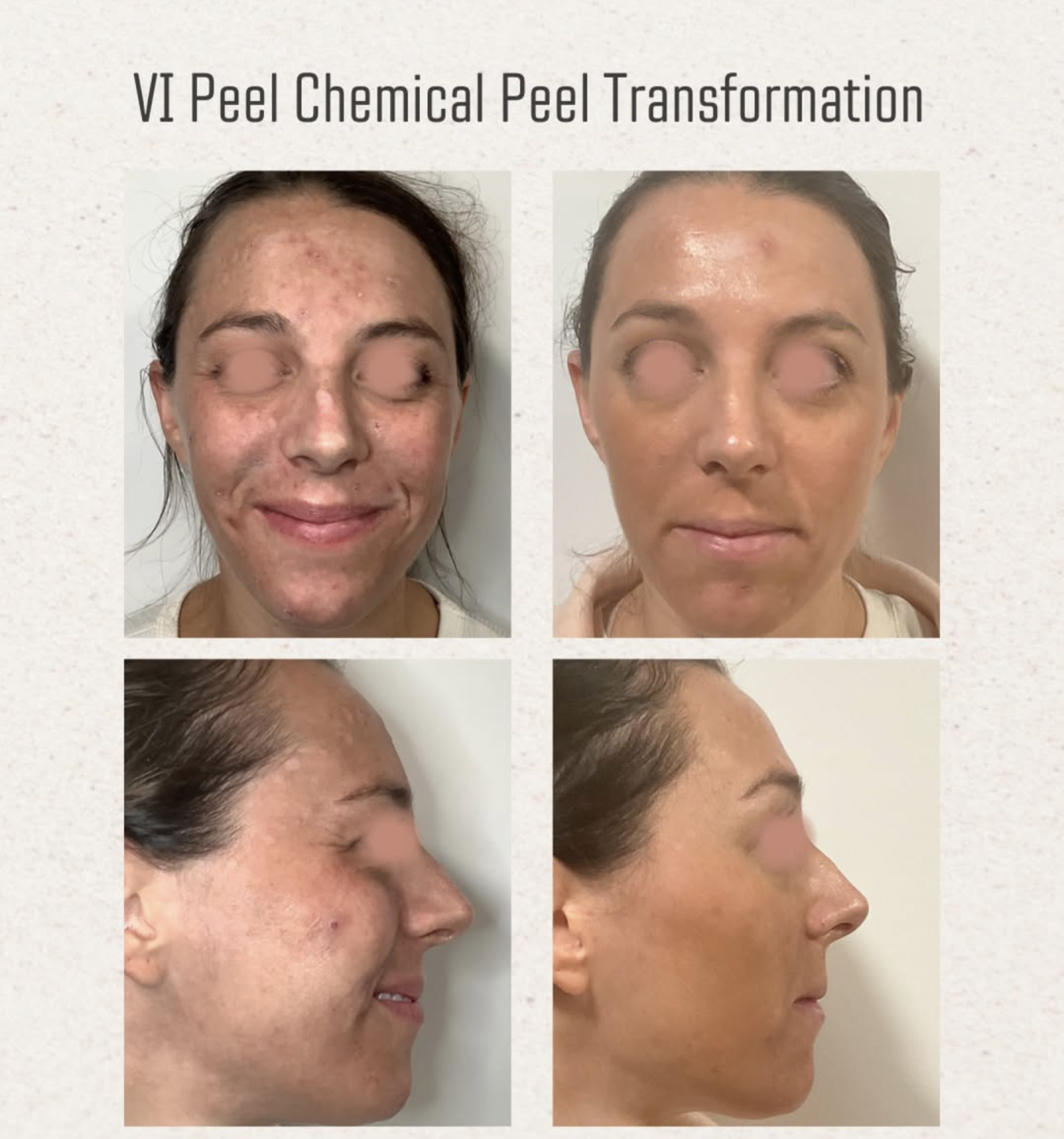 Skin & Tonic Brighton Instagram post