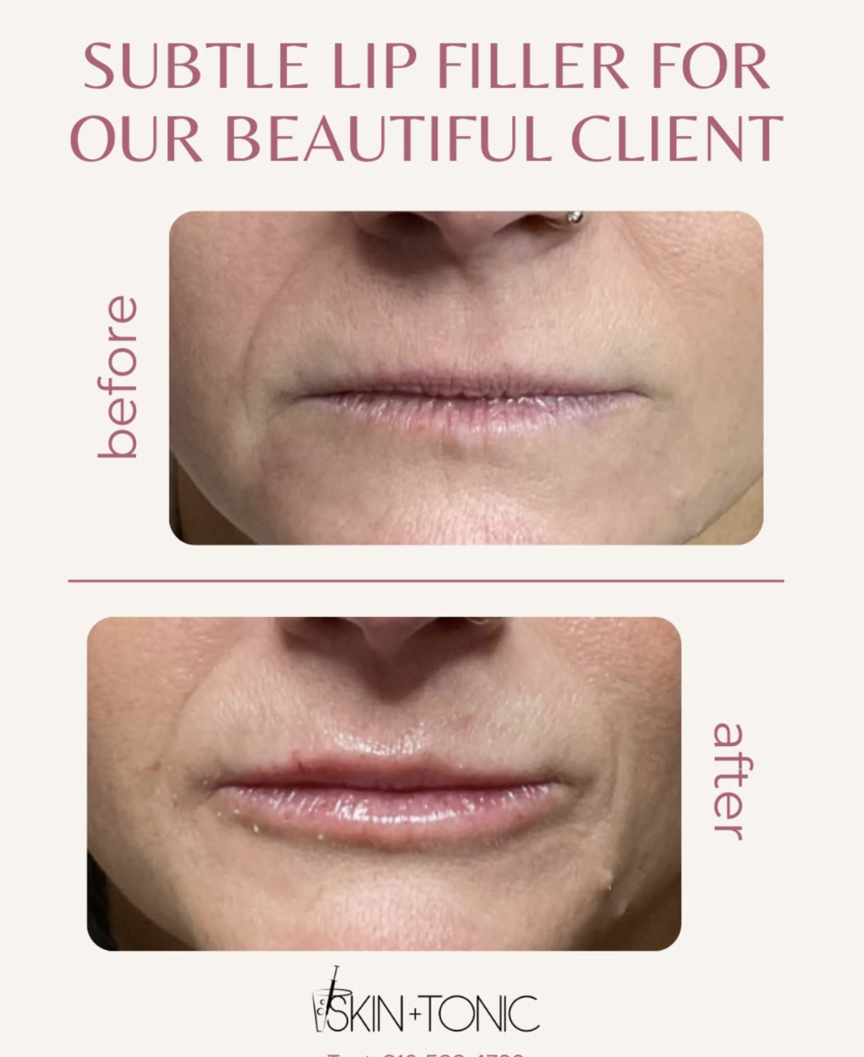 Skin & Tonic Brighton Instagram post